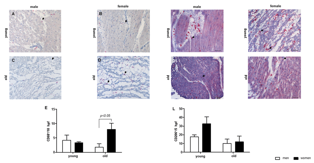 Aging effect on the number of macrophages in cardiac tissue. Representative images of cardiac cryosections stained with antibodies against (A-D) CD68, followed by (E) statistical analysis of CD68-positive cells per high power field (hpf). (F-K) CD206, followed by (L) statistical analysis of CD206-positive cells per high power field (hpf). The analyses were performed with myocard from young and old men (m) or women (w). Data are shown as the mean ± SEM (n= 6-8/group). Arrows show CD68- or CD206-positive cells.