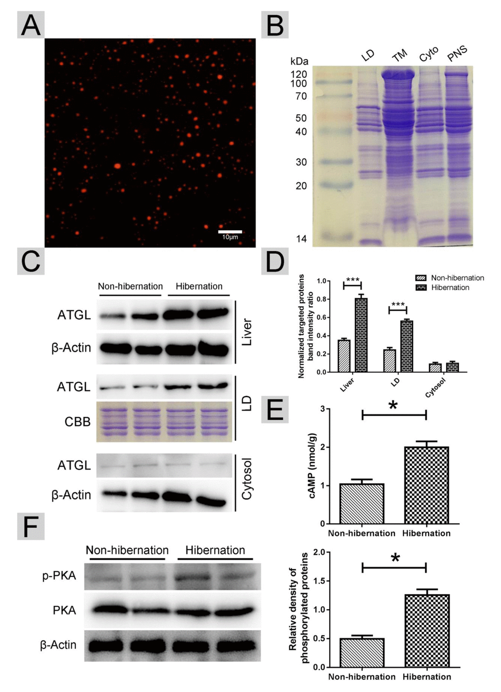 Activated cAMP/PKA signal increased ATGL accumulation on the surface of LDs. (A) Nile red staining of isolated LDs; (B) Colloidal blue staining of LDs, total membrane (TM), cytosol (Cyto) and post-nuclear supernatant (PNS) in the liver; (C) Western blot analysis of ATGL protein expression in the liver, LDs and cytosol; (D) Statistics of ATGL protein expression; (E) The cAMP level in the liver; (F) Differential phosphorylation of PKA in the liver.