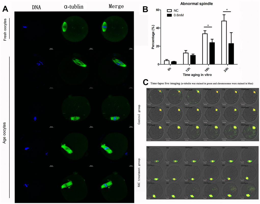 Treatment with NAC delays the changes in spindle anomalies of post-ovulatory oocyte aging in vitro. (A) Different morphological structures of spindles appeared in fresh and aged oocytes. Meiotic spindles in oocytes were stained with α-tubulin (green) and chromosomes were stained with Hoechst 33342 (blue). (B) Percentages of abnormal spindles in oocytes. Oocytes containing normal spindles and those with abnormal spindles were counted to calculate the percentage of abnormal spindles. NC, oocytes treated without NAC. 0.6mM, oocytes treated with 0.6mM NAC. Data are expressed as mean ± SEM of at least 3 independent experiments, and 6 superovulated mice were killed to obtain a minimum of 40 oocytes for each experiment. Data are expressed as mean ± SEM. Star represents mean difference, 0.01C) Control or NAC treated oocytes, which were microinjected with MAP4-eGFP mRNA and H2B-mCherry mRNA, and visualized by time-lapse live-cell imaging. The spindles are marked in green, and chromosomes are marked in red. Independent replicates were conducted with a minimum of 20 oocytes.