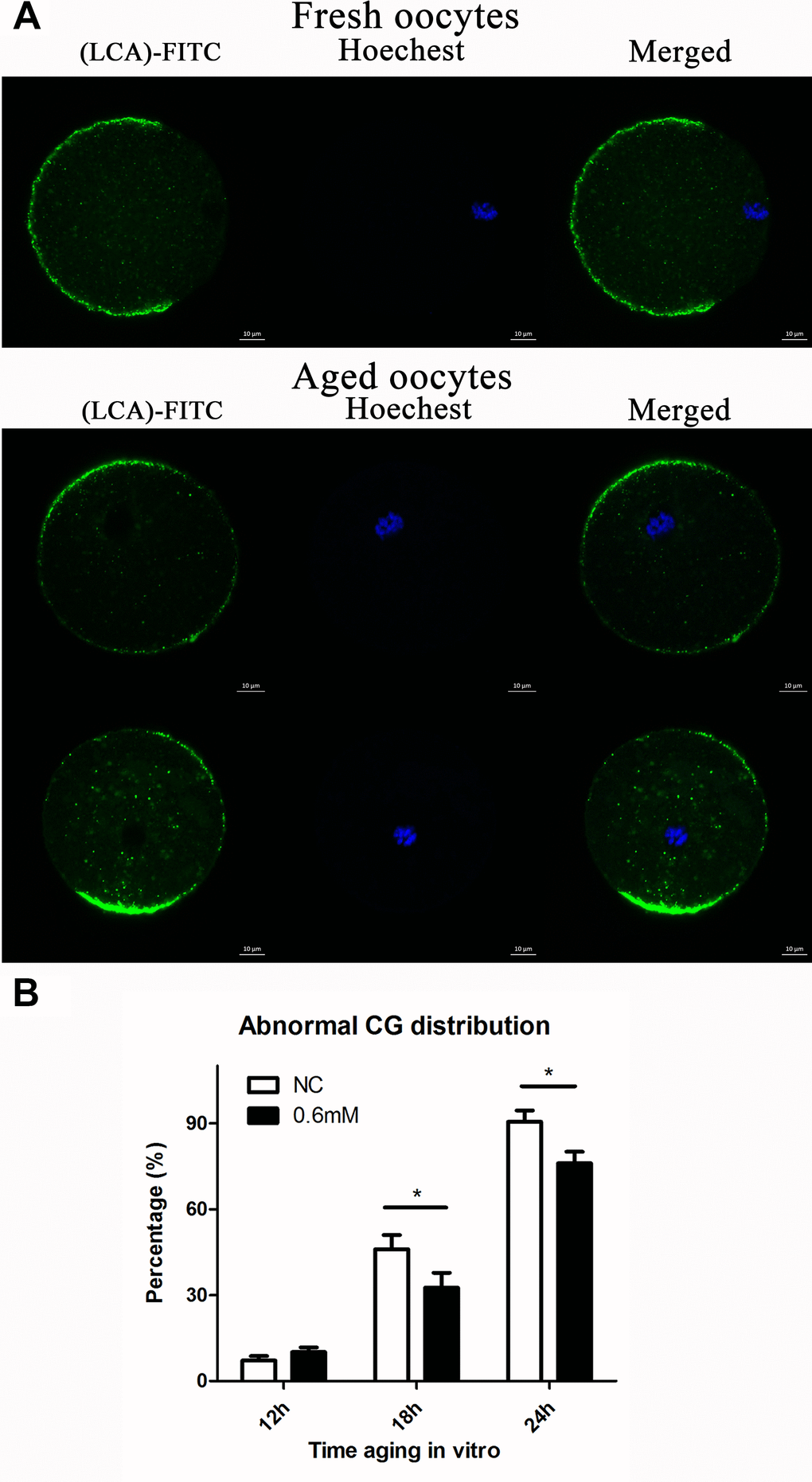 NAC administration maintains the normal distribution of CGs. (A) Different patterns of CG distribution in fresh and aged oocytes. CGs in oocytes were stained with lens culinaris (LCA)-FITC (fluorescein isothiocyanate: green) and chromosomes were stained with Hoechst 33342 (blue). The total number of oocytes in each experiment and the number of oocytes which showed abnormal CG distribution were counted to calculate the percentage of abnormal CG distribution in oocytes. (B) Percentages of abnormal distribution of CGs in oocytes. NC, oocytes treated without NAC. 0.6mM, oocytes treated with 0.6mM NAC. Data are expressed as mean ± SEM of at least 3 independent experiments, and 6 superovulated mice were killed to obtain a minimum of 40 oocytes for each experiment.