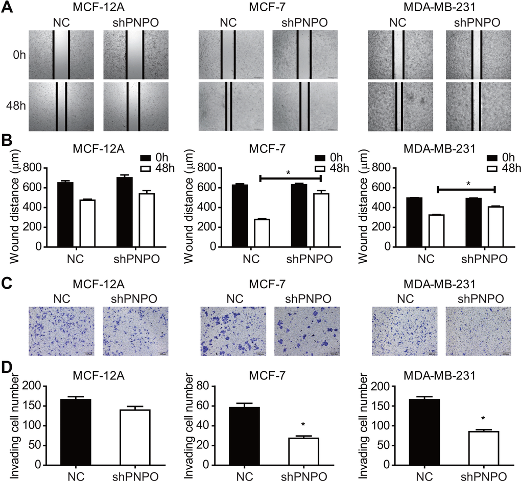 The effect of PNPO on breast cell migration and invasion. (A) Effect of PNPO knockdown by PNPO-shRNA on cell migration in MCF-12A, MCF-7, and MDA-MB-231 cells assessed by the wound-healing assay (Original magnification, x500). (B) Histograms show the quantitative analyses of wound distance at 0 and 48 h post-scratch (n = 3). (C) Effect of PNPO knockdown by PNPO-shRNA on cell invasion in MCF-12A, MCF-7, and MDA-MB-231 cells detected by the Transwell assay (Original magnification, x200). (D) Histograms show the number of invading cells (n = 3). NC, negative control of shRNA; shPNPO, PNPO-shRNA. * P 