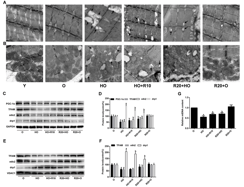 Effects of RSV on mitochondrial morphology and related protein expression in the GAS muscles. (A and B) Representative TEM images of the IFM and SSM at an original magnification of 25,000×. The short arrows indicate damaged mitochondria; the long arrows indicate lipid droplets. (C) Representative images of the western blotting results for PGC-1α, TFAM, mfn2 and drp1 in whole muscle lysates; GAPDH was used as a loading control. (D) The bar graphs show quantification of the indicated proteins. (E) Representative images of the western blotting results for TFAM, mfn2 and drp1 in the mitochondrial subfractions; VDAC1 was used as a loading control. (F) The bar graphs show quantification of the indicated proteins. (G) Relative mtDNA content. Data are expressed as the mean ± SD. aP bP 