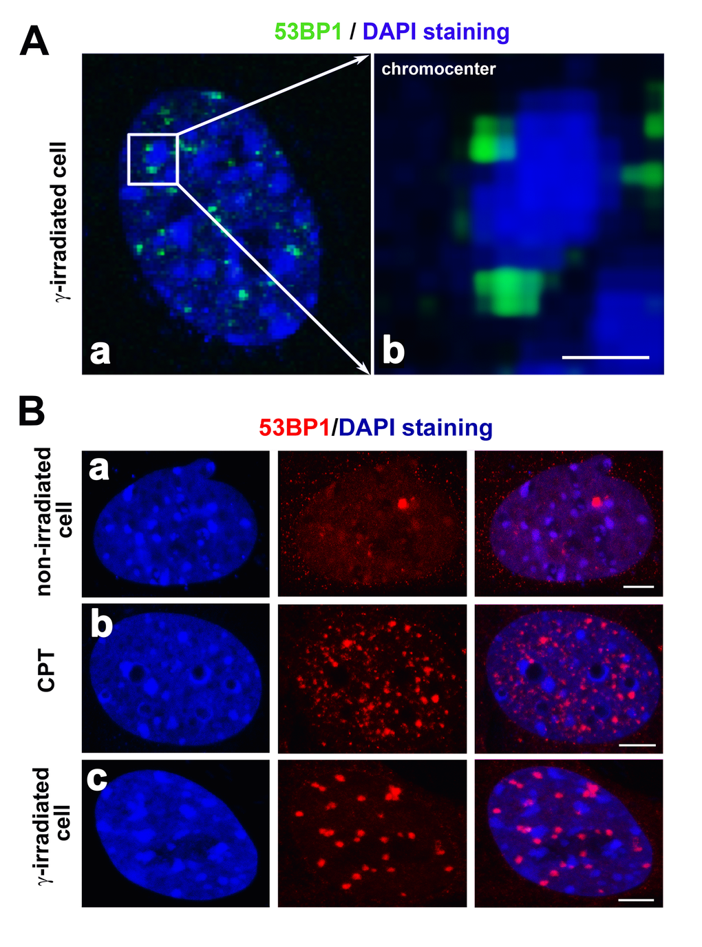 (A) Localization of the 53BP1 protein (green) in close proximity to chromocenters (clusters of centromeric heterochromatin; blue) is shown. Reindl et al. [68] showed that the 53BP1 protein localized in close proximity to the perichromatin region. This picture is our illustration of 53BP1 localization at the periphery of chromocenters. Here, DAPI was used for the visualization of MEF nuclei. In panel (A), chromocenters are characterized by dense DAPI staining. Panel (a) shows the DAPI-stained interphase nucleus and (b) is the magnified chromocenter (blue) decorated by 53BP1-positive foci (green). The scale bar represents 1 µm. (B) Compared to (a) non-irradiated cells, (b) tiny DNA damage foci may be induced by camptothecin (CPT) treatment. The 53BP1 protein (red) did not overlap with chromocenters in (c) γ-irradiated cells. The 53BP1 foci of CPT-treated cells were characterized by a distinct morphology compared to IRIF. A number of foci may be different in distinct cell lines and after cell exposure to distinct types of radiation or DNA damaging agents, as shown by [80] or [53], and see here. Scale bars in panels Ba-c represent 5 µm.