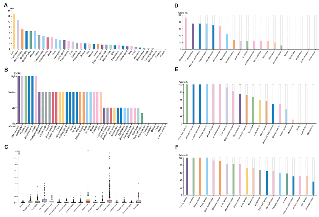 Expression of PIEZO2 in normal and cancer tissues from the HPA database. (A) PIEZO2 mRNA expression in different normal tissues; (B) PIEZO2 protein expression in different normal tissues; (C) PIEZO2 mRNA expression in different cancer tissues; (D) PIEZO2 protein expression in different cancer tissues (HPA031974); (E) PIEZO2 protein expression in different cancer tissues (HPA040616); (F) PIEZO2 protein expression in different cancer tissues (HPA015986).