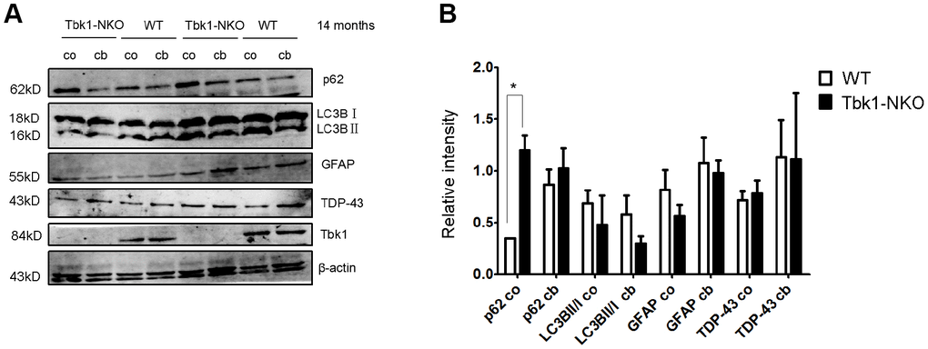 Analysis of autophagy markers. (A–B) Western blot expression analysis of p62, LC3B, GFAP, TDP-43, and Tbk1 in the cortex (co) and cerebellum (cb) of Tbk1-NKO and WT mice (n = 3); *P 