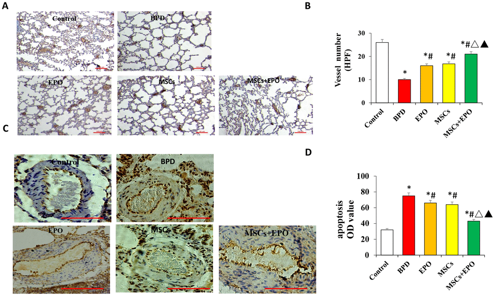 Vascular density and apoptosis detection by immunohistochemistry and qRT-PCR in vivo. (A) PECAM-1 staining of microvascular endothelial cells (×100 magnification). (B) Comparative analysis of vascular density in lung tissue. (C) TUNEL analysis of pulmonary vascular cells apoptosis in lung tissue. (D) Comparative analysis of the OD value of TUNEL-positive cells in each group. Data are presented as the mean ± SD. *P #P △P▲P