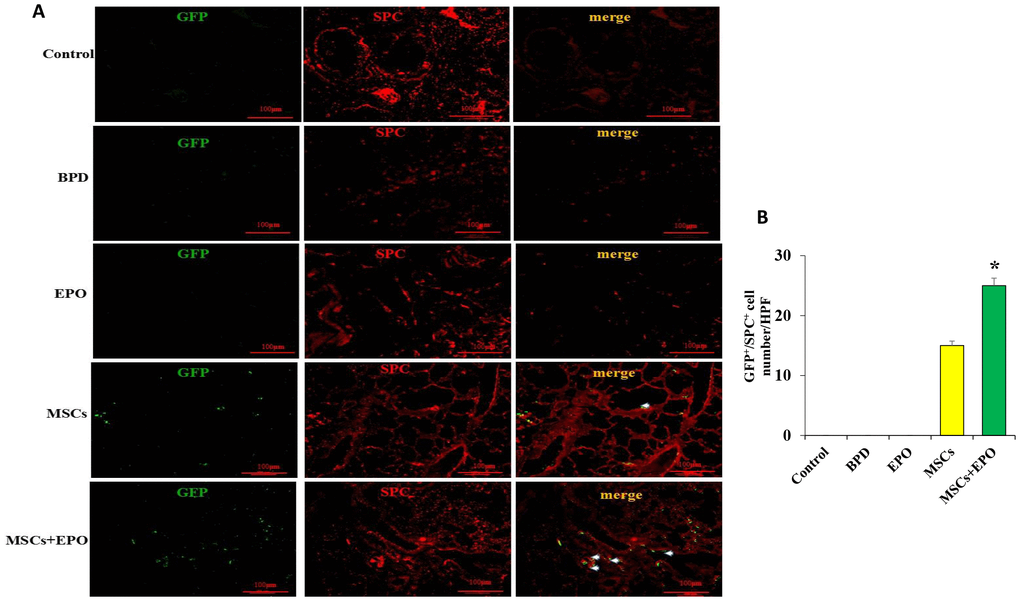 Identification of transplanted MSCs in lung tissue in vivo. (A) Transplanted cells were marked with GFP and the AECII-specific marker SP-C in red at ×200 magnification. (B) Comparative analysis of cell number in the MSCs and MSCs+EPO groups. Data are presented as the mean ± SD. *P 