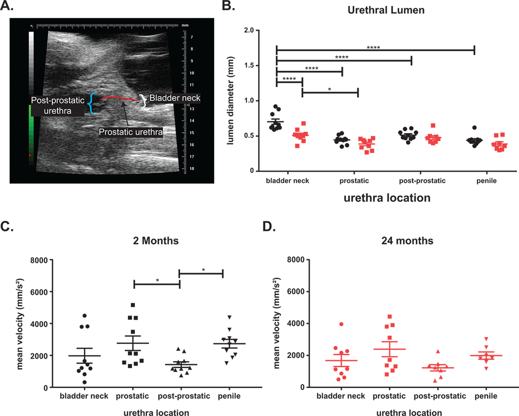 Aging leads to voiding changes as measured by ultrasound. (A) Ultrasound image showing the three urethra regions. (B) The urethral diameter is the largest at the bladder neck with a significant drop at the prostatic urethra before the diameter increases at the post-prostatic urethra in young mice. The post-prostatic urethra, while larger than the prostatic urethra is still significantly smaller than the bladder neck diameter. The penile urethra is slightly smaller than the post-prostatic urethra but significantly smaller than the bladder neck. There is a significant decrease in bladder neck diameter with age and a slight decrease at all other locations with age. The decrease of lumen diameter between bladder neck and diameter is still significant in aged mice. (C) The mean velocity through the urethra of young mice show a significant decrease between prostatic and post-prostatic and a significant increase between post-prostatic and penile consistent with a narrowing of lumen diameter. (D) The mean velocity is highest at the prostatic urethra in aged mice, but the changes in velocity is lost with age. The mean velocity of flow in aged mice is lower than mean velocity in young mice. *, p-value 