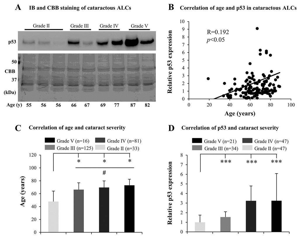 Senescence associated markers increase with the grades of age-related cataract (ARC) in human anterior lens capsules (ALCs). Human ALCs graded before surgery for cataract severity using the Emery-Little Classification System of nuclear opacity grade were obtained from the anterior surface of cataractous lenses during surgery. (A) Photographs for representing immunoblot analysis of p53 and corresponding Coomassie brilliant blue (CBB) staining in cataractous ALCs of different grades and ages. (B) Relative expression levels of p53 immunoblots in cataractous ALCs. Quantification of immunoblots was processed using Image J. The figure depicts Pearson correlation between age and p53 protein expression (n = 144). (C) The correlation between patient age and ARC grades (Data were analyzed via One-way ANOVA). (D) The correlation between relative p53 expression and ARC grades (Data are analyzed via Wilcoxon Rank Sum Test). Data were shown as mean ± SD. *, pppp