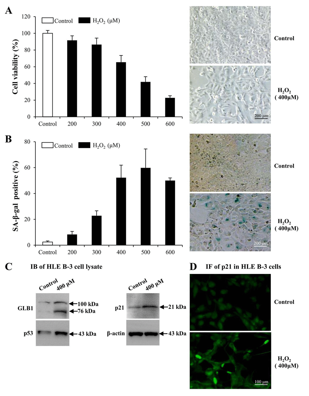 Premature senescence model of human lens epithelial cells (HLE B-3) induced by H2O2. Cells of the control group were cultured in medium only, whereas cells of senescent group were cultured in medium with H2O2 for 96 h. (A) Viabilities (left) of HLE B-3 cells treated with different concentrations of H2O2 (0–600 μM) for 96 h, as measured via an MTT assay. Morphologic changes (right) of HLE B-3 cells following a 96 h exposure to 400 μM H2O2. (B) Percentage of SA-β-gal-positive cells in HLE B-3 cells treated with different concentrations of H2O2 (0–600 μM) (left). SA-β-gal activity as measured by cell staining (right). (C) Immunoblot analysis of GLB1, p21 and P53 in HLE B-3 cells. (D) Immunofluorescence analysis of p21 (green) in HLE B-3 cell nuclei. (Scale bars: 100 μm). Data were shown as mean ± SD and are representative of 3 independent experiments.