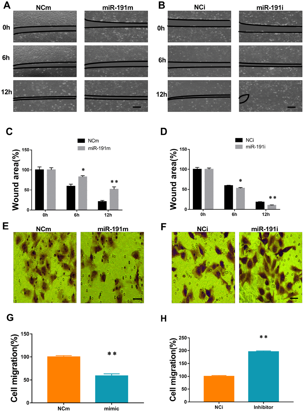 MiR-191 inhibited cell migration. (A, B) Phase contrast microscopic images of HUVECs at 0, 6, and 12 h after scratching. The cells were transfected with miR-191 mimic (A), miR-191 inhibitor (B), or the corresponding scrambled NCm (A) and NCi (B). Black lines indicate the wound area. Scale bars, 100 μm. (C, D) Size of wound area (percentage of 0 h) created by scratching HUVECs transfected with miR-191 mimic (C) or miR-191 inhibitor (D) (n =6 per group). (E, F) Phase contrast microscopic images of HUVECs migrated and attached to the bottom membrane of a transwell. The cells were transfected with miR-191 mimic (E), miR-191 inhibitor (F), or the corresponding scrambled NCm (E) and NCi (F). Scale bars, 20μm. (G, H) Number of migrated HUVECs (percentage of NCm or NCi) transfected with miR-191 mimic (G) or miR-191 inhibitor (H) (n =6 per group). Means ± SEM. * P