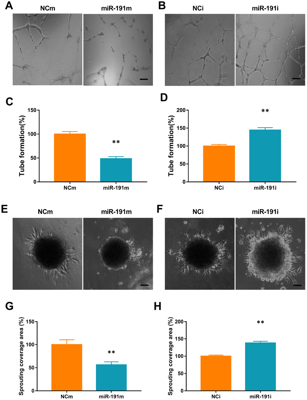 miR-191 inhibited tube formation and spheroid sprouting. (A, B) Phase-contrast microscopic images of tubeforming HUVECs that were transfected with miR-191 mimic (A), miR-191 inhibitor (B), or the corresponding scrambled NCm (A) and NCi (B). Scale bars, 20μm. (C, D) Tube formation of HUVECs (percentage of NCm or NCi) transfected with miR-191 mimic (C) or miR-191 inhibitor (D) as assessed by tube formation assay (n =6 per group). (E, F) Phase-contrast microscopic images of sprouting HUVECs spheroids. HUVECs were transfected with miR-191 mimic (E), miR-191 inhibitor (F), or the corresponding scrambled NCm (E) and NCi (F). Scale bars, 20μm. (G, H) Sprouting coverage area of HUVECs (percentage of NCm or NCi) transfected with miR-191 mimic (G) or miR-191 inhibitor (H) as assessed by spheroid sprouting assay (n = 6 per group). Means ± SEM. ** P