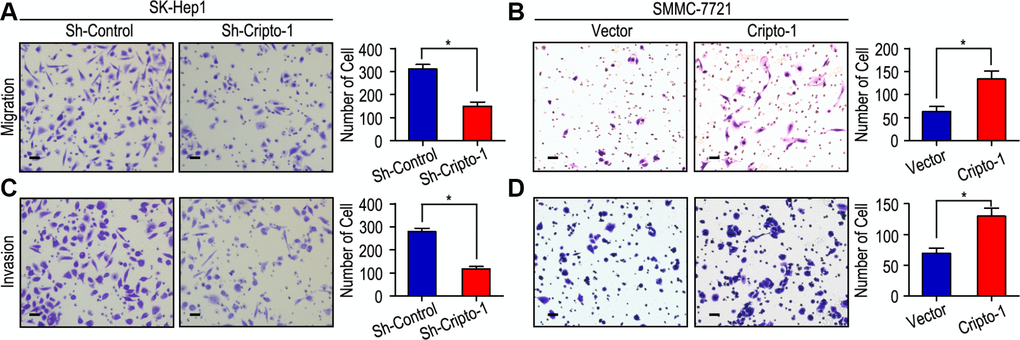 Cripto-1 promotes cell migration and invasion in HCC cell lines. (A, C) Down-regulated Cripto-1 expression in SK-Hep1 cells and suppressed cell migration and invasion. (B, D) Up-regulated Cripto-1 expression in SMMC-7721 cells and accelerated cell migration and invasion. The scale bar represents 50 μm.