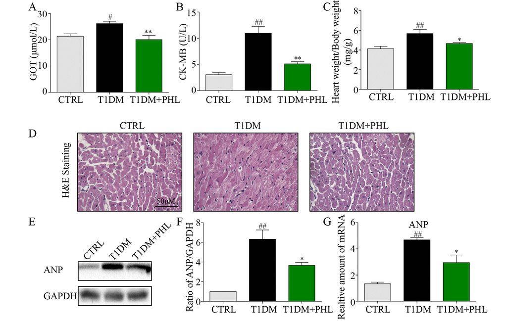 Phloretin reduced hyperglycemia-induced biochemical indicators, improved histological abnormalities and cardiac hypertrophy of diabetic cardiomyopathy. (A) The serum level of AST. (B) The serum level of CK-MB. (C) The ratio of heart weight/body weight. (D) Representative histomorphometric images for the haematoxylin and eosin staining (H&E) of formalin-fixed myocardial tissues from each group (400x magnification). (E-F) Western blot analysis for the protein expression of ANP in the myocardial tissues was performed. (G) The mRNA expression of the pro-hypertrophic gene ANP in myocardial tissues was detected by RT-qPCR. More than five mice in each group were used for above analysis. *P #P ##P 