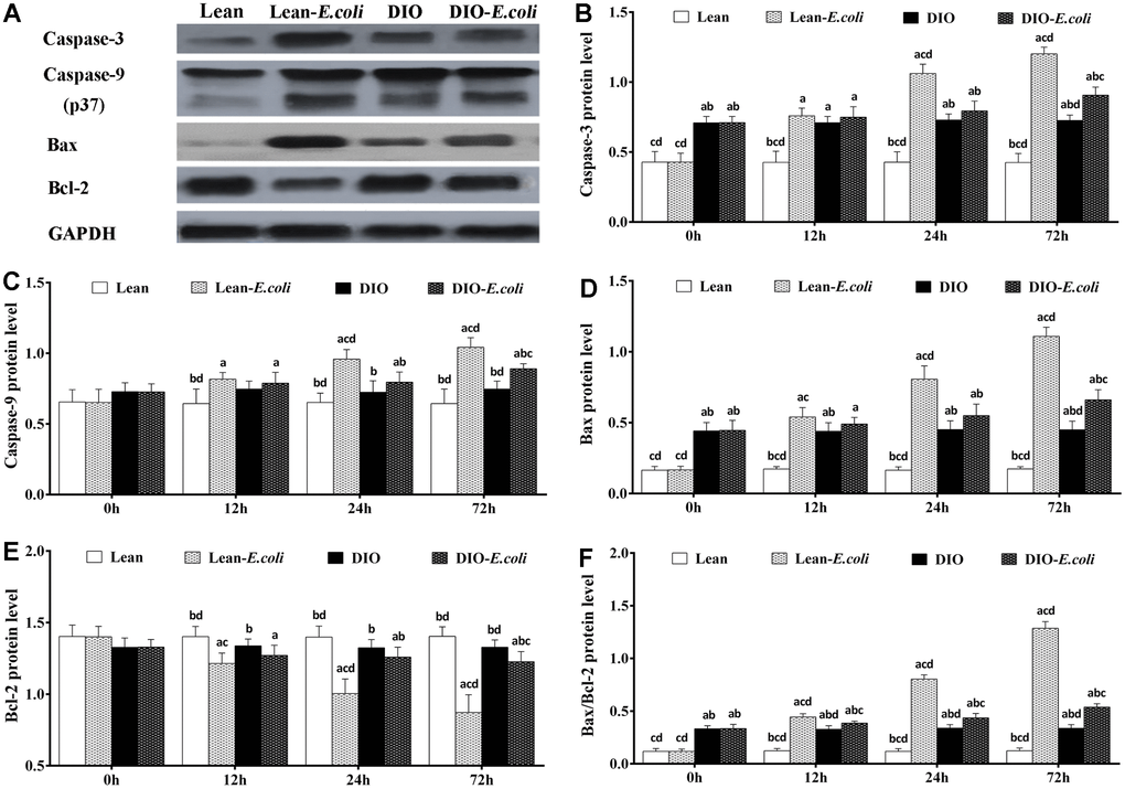 The changes of protein levels in the mice liver after E. coli infection. (A) The representative image of apoptotic regulatory proteins at 72h after receiving intranasal instillations. (B–F) Quantitative analysis of the relative protein expression (expressed as fold change relative to the lean group). Note: Letter a, b, c or d represent difference (pE. coli group, DIO group, or DIO-E. coli group, respectively.