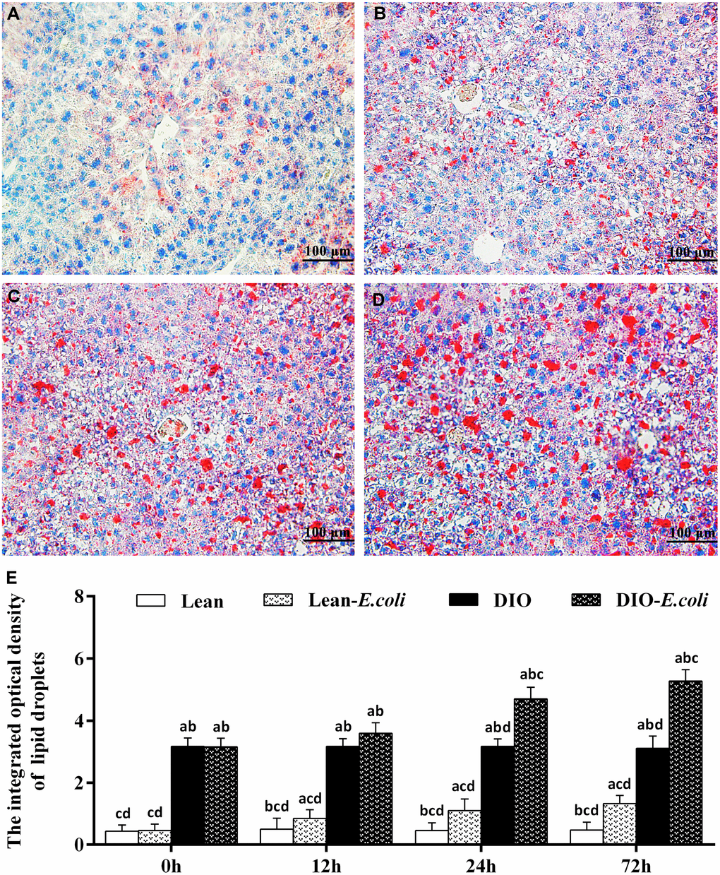 The changes of lipid droplet deposition in the liver after E. coli infection. (A–D) The representative images of the liver lipid droplets deposition at 72h after receiving intranasal instillations (Oil Red O staining, bar=100 μm). (A) lean group; (B) lean-E. coli group; (C) DIO group; (D) DIO-E. coli group; (E) the integrated optical density of hepatic lipid droplets. Note: Letter a, b, c or d represent difference (pE. coli group, DIO group, or DIO-E. coli group, respectively.