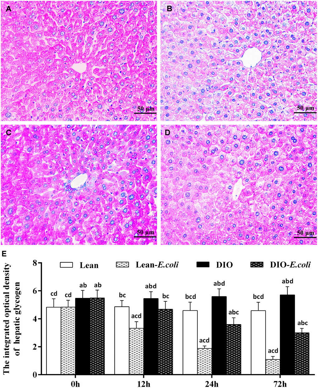 The changes of hepatic glycogen in the liver after E. coli infection. (A–D) The representative images of the hepatic glycogen deposition at 72h after receiving intranasal instillations (PAS staining, bar=50 μm). (A) lean group; (B) lean-E. coli group; (C) DIO group; (D) DIO-E. coli group; (E) The integrated optical density of hepatic glycogen. Note: Letter a, b, c or d represent difference (pE. coli group, DIO group, or DIO-E. coli group, respectively.