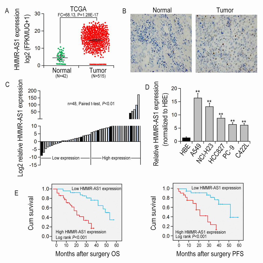 HMMR-AS1 overexpression is associated with poor prognosis. (A) Relative expression of HMMR-AS1 was analyzed by TCGA data. (B) HMMR-AS1 expressions in LUAD tissues and the adjacent para-carcinoma tissues were detected by in situ hybridization. (C) HMMR-AS1 expression in LUAD tissues was analyzed by qRT-PCR (n=48). (D) HMMR-AS1 expression in LUAD and HBE cells analyzed by qRT-PCR analysis. (E, F). Kaplan-Meier OS and DFS curves of patients with different HMMR-AS1 expression levels were plotted by the Kaplan-Meier method. *P 