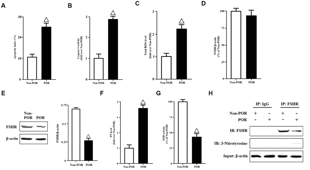 Molecular characteristics of human GCs from non-POR and POR groups. (A) The apoptotic indices of human GCs were measured using in Situ cell death detection kit. (B) The caspase-3 enzyme activities of human GCs were assayed using a commercial kit. (C) Total ROS levels of human GCs were measured by DCFH. (D) Relative mRNA expressions of FSHR in human GCs were determined by RT-PCR (β-actin as internal standard). (E) Relative protein expressions of FSHR in human GCs were determined by immunoblots (β-actin as internal standard). (F) PN levels of human GCs were measured by DHR. (G) The SOD activities of human GCs were measured using SOD activity assay kit. (H) Identification of tyrosine nitrated FSHR protein in human GCs. FSHR proteins were purified from cell lysates, and the relative protein expressions of nitrated FSHR were determined by immunoblots (β-actin as internal standard). Open triangle: p