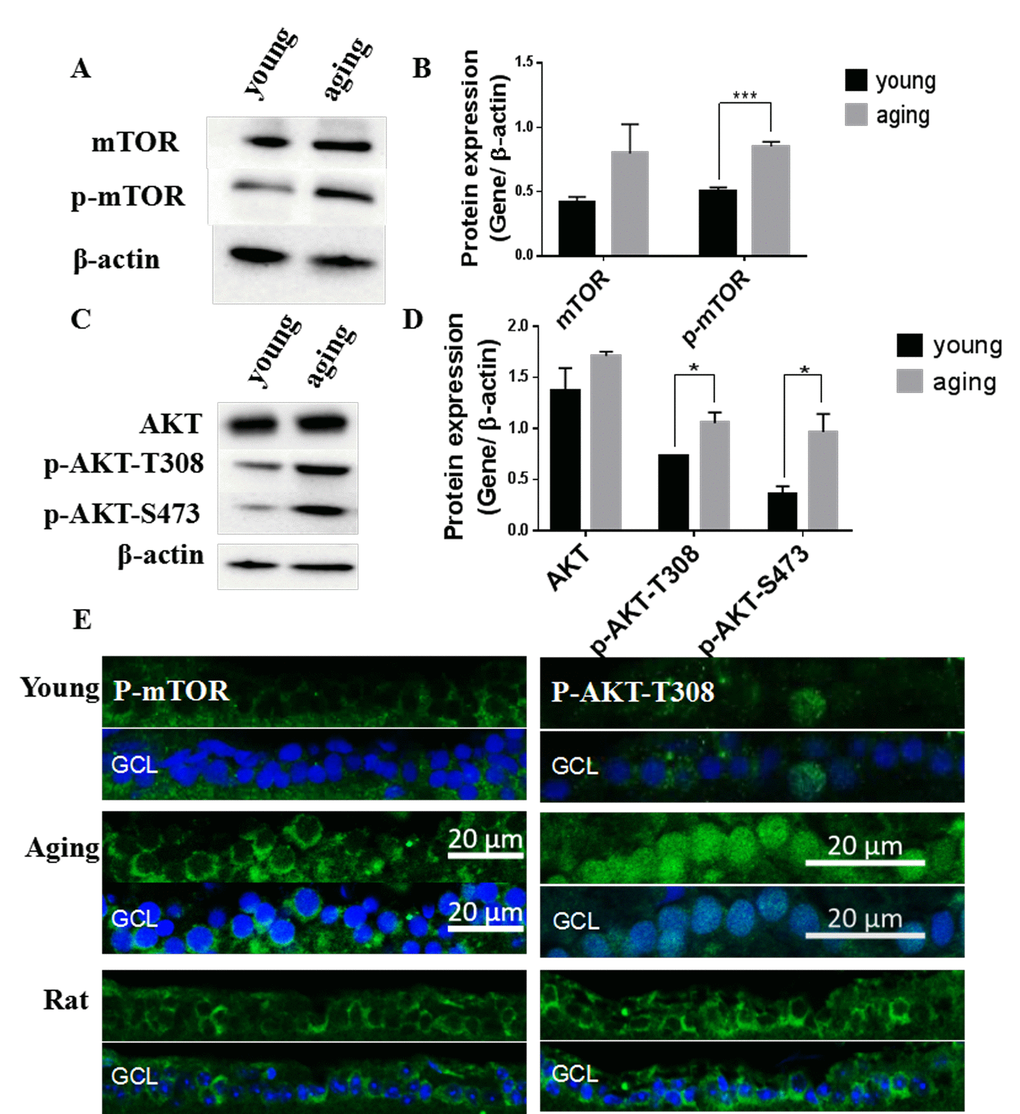 Activation of the Akt/mTOR pathway in aging zebrafish retinas. (A) Representative western blot showing the protein level of mTOR and p-mTOR in young and aging zebrafish retinas. (B) Densitometric mean and SEM normalized to the corresponding level of the loading control protein beta-actin (***PC) Representative western blot showing the protein expression level of Akt and p-Akt-T308 and p-Akt-S473 in young and aging zebrafish retinas. (D) Densitometric mean and SEM normalized to the corresponding level of the loading control protein beta-actin (*PE) Photographs of fluorescent immunostained retina cross-sections showing the localization and relative levels of p-mTOR and p-Akt-T308 in the RGC layers of young and aging zebrafish retinas. All photographs were taken at 40x magnification except rat sections were at 20x magnification and p-Akt-T308 at 60x magnification. Young, 4-6 months old zebrafish; Aging, 19-23-month-old zebrafish; Rat, positive control; GCL, ganglion cell layer.