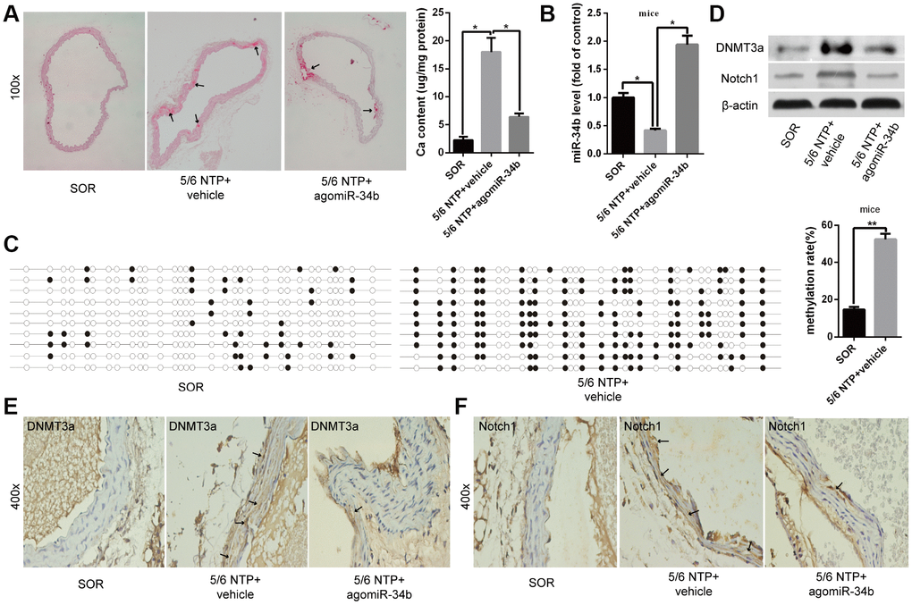 MiR-34b inhibited vascular calcification in mice. (A) Alizarin Red S staining showed calcified arteries in 5/6 NTP+vehicle mice but not SOR mice, and calcification was attenuated in 5/6 NTP+agomiR-34b mice. n = 5. Representative images were shown. The arrows indicate calcification sites in the mouse artery. (B) qRT–PCR showed the expression of miR-34b in SOR group mice, 5/6 NTP+vehicle mice and 5/6 NTP+agomiR-34b mice, respectively. (C) BSP showed the methylation rate of CpG sites of miR-34b DNA in arteries from 5/6 NTP+vehicle mice, was significantly higher than that from SOR arteries. n = 3. Representative images were shown. (D–F) The levels of DNMT3a and Notch1 were determined by western blot and immunohistochemistry staining analysis among arteries from the SOR group, 5/6 NTP+vehicle mice and 5/6 NTP+agomiR-34b mice, respectively. The data were expressed as mean ± SD, *p 