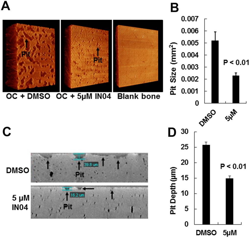 IN04 treatment impairs osteoclast function. (A) Representative images of bone resorption pits on bone slices scanned by nano-CT. Bone slices described in Figure 5, and a blank bone slice (1.5x1.5 mm) was scanned by nano-CT is shown. (B) Quantitative data of pit size in area on bone slices. (C) Representative images of vertical section of bone resorption pits on bone slices. (D) Quantitative data of pit depth on bone slices, measured by nano-CT. Data are presented as mean ± SEM. P P 