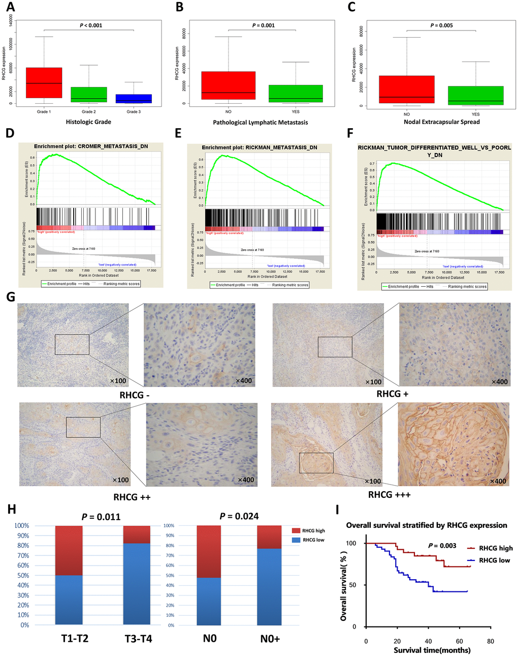 RHCG is correlated with HNSCC progression-associated traits. (A–C) The expression levels of RHCG in different subgroups of 299 HNSCC patients stratified by histologic grade (A), pathologic nodal metastasis(B) and nodal extracapsular spread in the TCGA database; (D–F). GESA analysis of HNSCC-specific tumor progression signatures enriched in RHCG-high or RHCG-low HNSCC patients in the TCGA database. (G) Representative immunohistochemical staining degrees for RHCG in 70 HNSCC tissues. (H) Correlation of RHCG expression with tumor stage and lymph node metastasis in 70 HNSCC patients by Fisher's exact test. (H) Kaplan–Meier curves of 70 HNSCC patients stratified by the RHCG expression, log-rank test was used to test the difference between two groups.