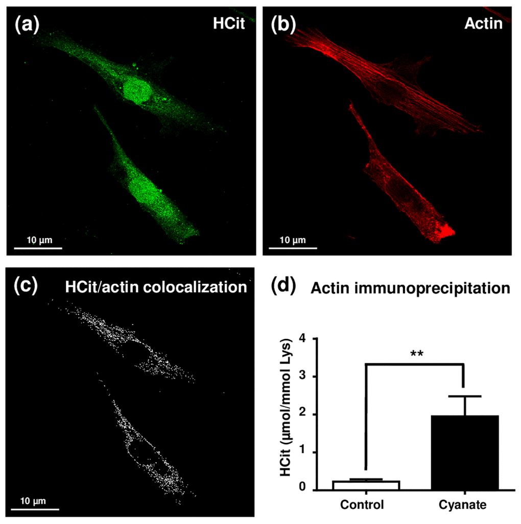 Localization of intracellular carbamylated proteins. Fibroblasts were seeded in chambered coverglass system and incubated for 5 days with DMEM containing 0.5% (v/v) FBS and 5 mmol/L cyanate. At the end of incubation, cells were fixed with 4% (v/v) paraformaldehyde and permeabilized with 0.25% (v/v) Triton X-100 before immunolabelling of carbamylated proteins using an anti-HCit polyclonal antibody (a). Cells were also labelled using ActinRed 555 ReadyProbes® in order to identify actin fibers (b). Colocalization points between HCit and actin labelling were identified using ImageJ software (c). In a second set of experiments, fibroblasts were incubated in the same conditions without (control) or with 5 mmol/L cyanate before preparing total cell extracts which were then used for β-actin immunoprecipitation. The immunoprecipitates were submitted to acid hydrolysis before HCit quantification by LC-MS/MS (d). The data are presented as means ± SEM (n=4) compared using the Mann-Whitney U test (**: p