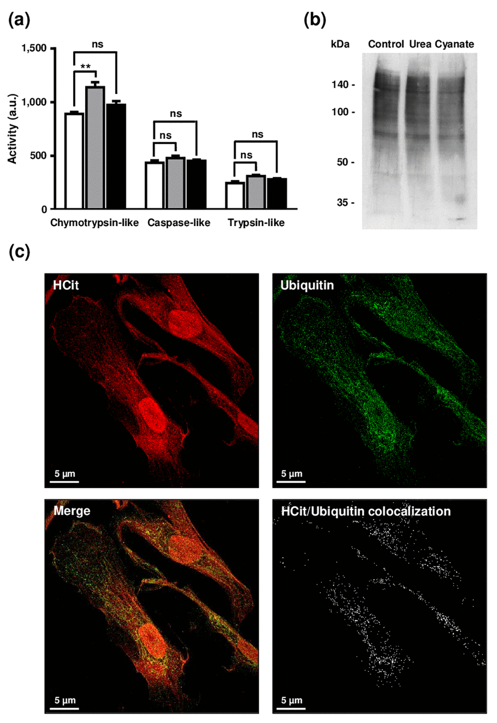 Impact of carbamylation on proteasome proteolytic activities and on the ubiquitination process. (a) Evaluation of proteasome proteolytic activity after incubation of cells with urea or cyanate: confluent fibroblasts were incubated for 4 weeks at 37°C with DMEM + 0.5% (v/v) FBS without (control conditions, open bars) or with 20 mmol/L urea (grey bars) or 0.5 mmol/L cyanate (black bars). Chymotrypsin-like, caspase-like and trypsin-like activities have been measured in cell extracts using the corresponding Proteasome-Glo™ assays. The data are presented as means ± SEM (n=6) and compared using the Mann-Whitney U test (ns: non significant, **: pb) Ubiquitination level of intracellular proteins after incubation of cells with urea or cyanate: confluent fibroblasts were incubated for 4 weeks at 37°C with DMEM + 0.5% (v/v) FBS without (control conditions) or with 20 mmol/L urea or 0.5 mmol/L cyanate, and cell extracts were prepared and submitted to western-blot analysis using an anti-ubiquitin antibody. (c) Anti-HCit and anti-ubiquitin immunolabellings were performed using fibroblasts previously seeded (10,000 cells/well) in chambered coverglass system and incubated for 2 days with DMEM containing 0.5% (v/v) FBS and 5 mmol/L cyanate. At the end of incubation, cells were fixed with 4% (v/v) paraformaldehyde and permeabilized with 0.25% (v/v) Triton X-100 before immunolabelling of proteins using both anti-HCit and anti-ubiquitin antibodies. Colocalization points between HCit and ubiquitin labelling were identified using ImageJ software.