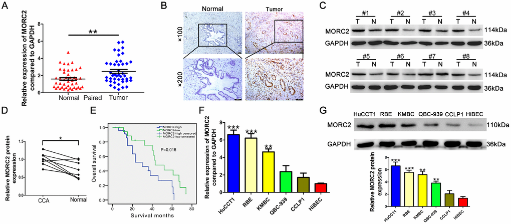 MORC2 is highly expressed in CCA and is associated with poor prognosis. (A) The expression of MORC2 mRNA was determined in 44 pairs of CCA samples. (B) The expression of MORC2 in paired CCA samples from cohort 2 was confirmed by immunohistochemical staining. Representative examples of MORC2 staining are shown. (C) The protein expression of MORC2 was examined in 8 pairs of CCA tumor tissues (T) and corresponding normal tissues (N). (D) The relevant density of MORC2 protein was compared, and the results are shown in the scatter plot. (E) Kaplan-Meier survival analyses were conducted to evaluate the influence of MORC2 on overall survival. (F–G) mRNA and protein expression levels of MORC2 were evaluated by RT-qPCR and western blotting in six CCA cell lines. ***P 