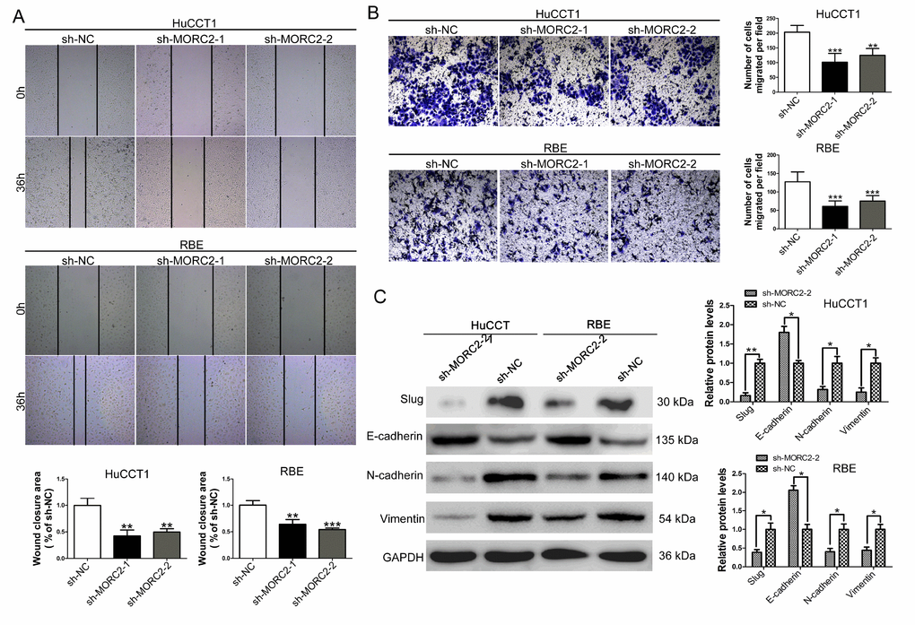 MORC2 knockdown impairs the migratory and invasive capacities of CCA cells. (A) The wound healing assay was used to determine the migration of MORC2 stable knockdown HuCCT1 and RBE cells. (B) Cell invasion was investigated by transwell assays in MORC2 stable knockdown HuCCT1 and RBE cells. (C) Slug, E-cadherin, N-cadherin and vimentin protein levels were detected and quantified in MORC2 stable knockdown HuCCT1 and RBE cells by western blotting. All experiments were performed in triplicate, ***P 