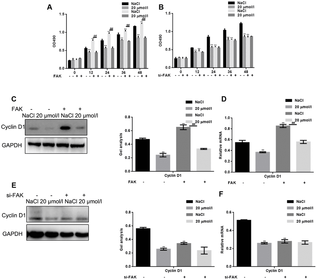 Apigenin inhibits HSF cell survival by suppressing FAK phosphorylation. (A) HSFs overexpressing vector or FAK were treated with 20 μM apigenin, after which MTT assays were performed at the indicated times. Results depict the mean±SD of three experiments done in triplicate. **P P B) HSFs transfected with si-FAK or si-NC (negative control) were treated with 20 μM apigenin, after which MTT assays was performed at the indicated times. Results depict the mean±SD of three experiments done in triplicate. **P C, D) HSFs overexpressing empty vector or FAK were treated with 20 μM apigenin, after which western blot and real-time PCR assays were performed to detect levels of cyclin D1 expression. **P P E, F) HSFs transfected with si-FAK or si-NC (negative control) were treated with 20 μM apigenin, after which western blot and real-time PCR assays were performed to detect levels of Cyclin D1 expression. **P 