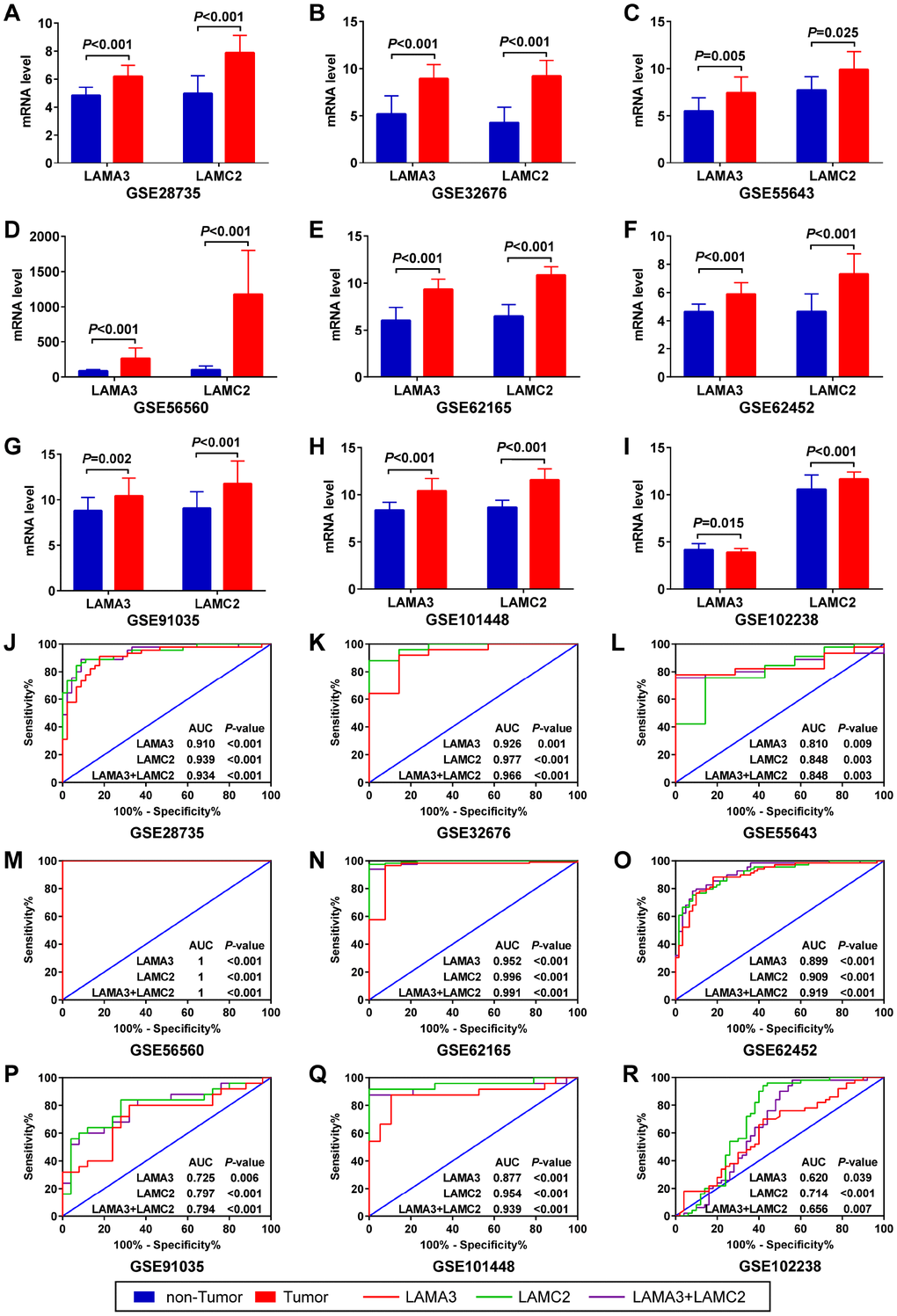 Expression and ROC analysis of LAMA3 and LAMC2 in GEO PDAC and non-tumor tissues. (A–I) Comparison of LAMA3 and LAMC2 gene expression in tumor and non-tumor tissues. (J–R) ROC curve of LAMA3, LAMC2 and combined expression for distinguishing between PDAC and non-tumor tissues.