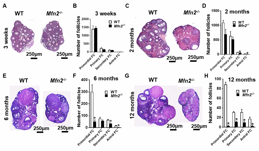 Accelerated follicle depletion in Mfn2-/- mice. (A, C, E, G) Representative micrographs of 3-weeks and 2-, 6- and 12-months old Mfn2-/- and WT mice ovary sections stained with hematoxylin and eosin. (B, D, F, H) Follicle counts in 3-weeks and 2-, 6- and 12-months old Mfn2-/- and WT mice ovaries. Data presented as mean ± SEM. *p t-test.