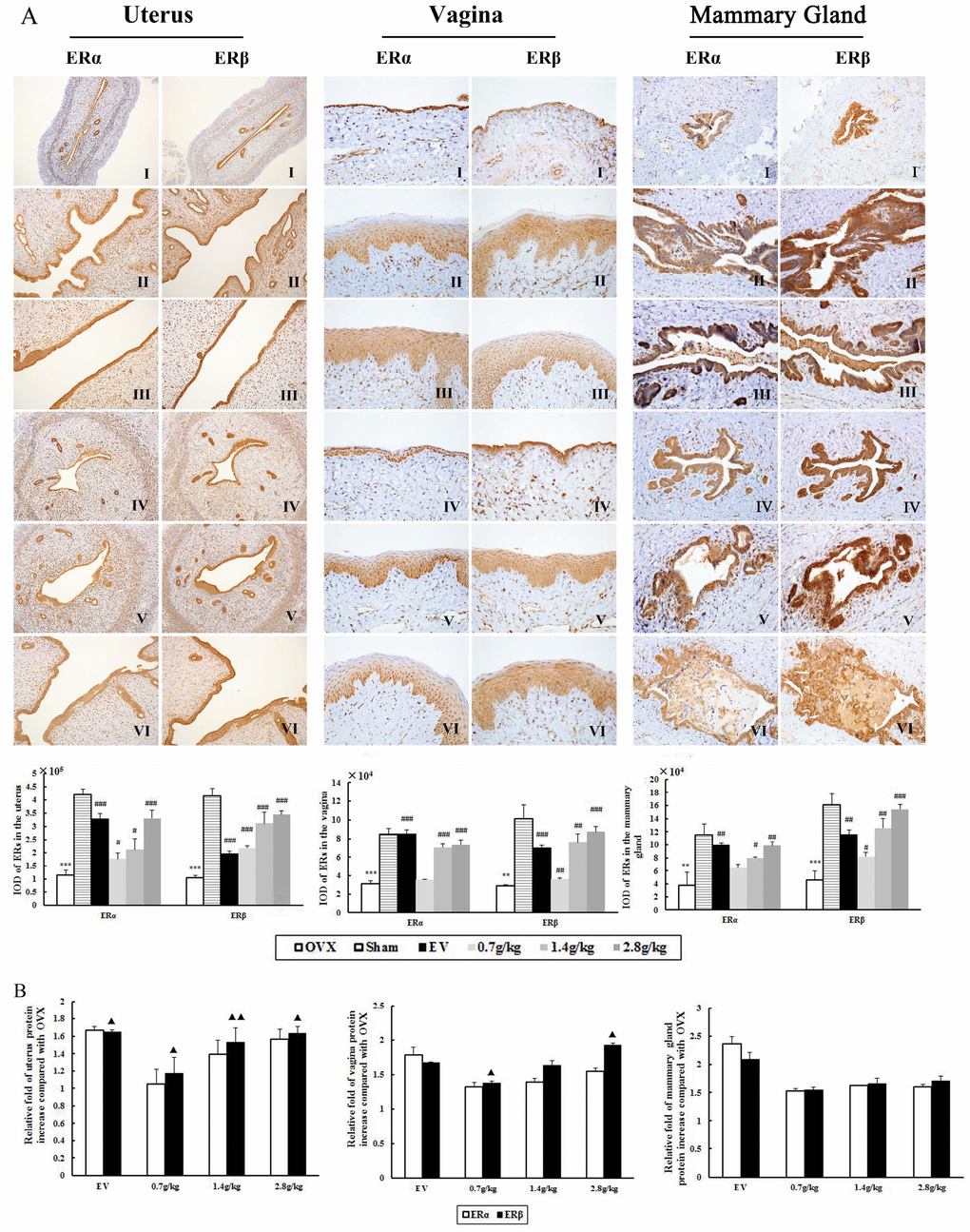 The effects of QYFE treatment on the expression of estrogen receptor (ER) α and estrogen receptor (ER) β in the uterus, vagina and mammary gland. (A) ERα and ERβ expression was assessed by quantitative immunohistochemistry. Representative photomicrographs taken at 200-X magnification of uterus and 400-X magnification of vagina and mammary gland sections from each treatment group are shown: (I) Untreated ovariectomized (OVX) rat; (II) sham-operated rat; (III) OVX rat treated with estradiol valerate (EV); and OVX rat treated with (IV) 0.7 g/kg, (V) 1.4 g/kg, and (VI) 2.8 g/kg QYFE. Data are the mean standard deviation (SD) of samples from 10 rats. *** pB) Comparative Statistical analysis of ERα and ERβ upregulation to OVX group (▲) p