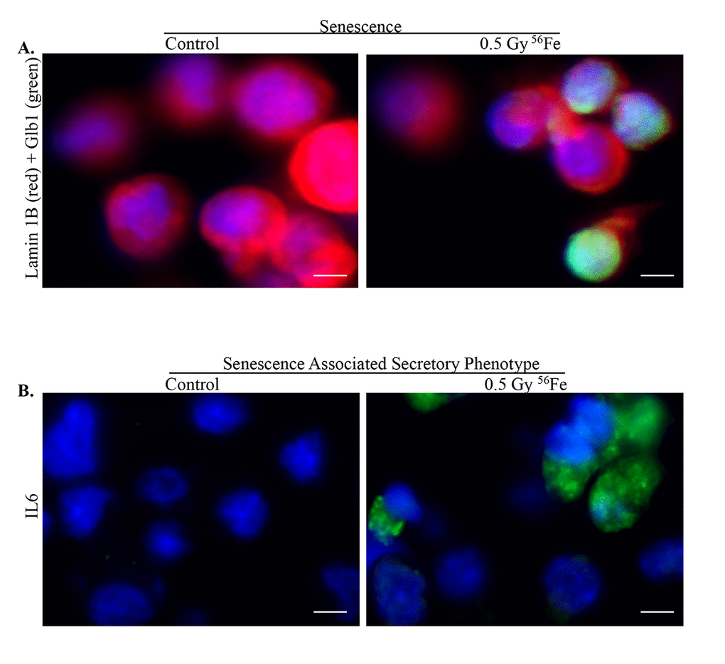 Senescence and SASP in ISCs after exposure to heavy ion radiation. (A) Representative IF images of ISCs co-stained for senescent markers Lamin 1B (red) and Glb1 (green) showing decreased expression of Lamin 1B in senescent cells. (B) Increased expression of SASP marker IL6 after heavy ion iron radiation exposure. Scale bars, 5 μm.