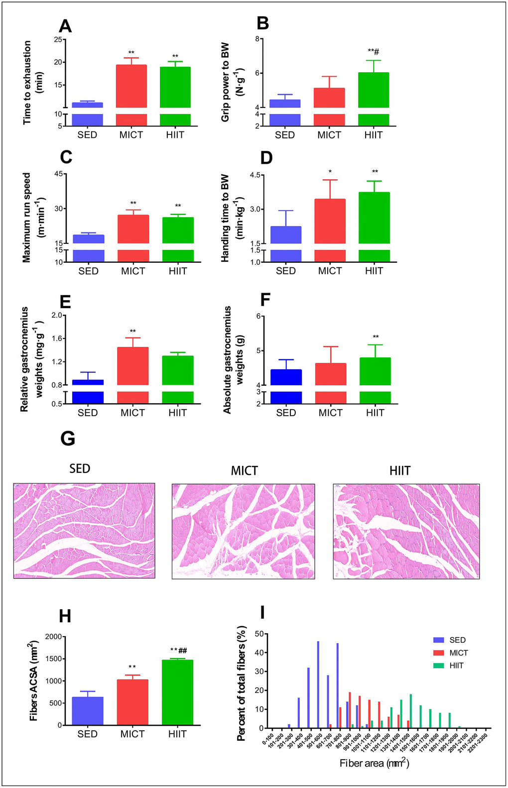 Effect of MICT and HIIT protocols on physical performance and fiber cross sectional area. Changes in time to exhaustion (min) (A), grip strength (N·g–1) (B), maximum run speed (m·min-1) (C), inclined plane performance (D), relative gastrocnemius weight (E), absolute gastrocnemius weight (F), muscle fiber morphology (G), mean cross-sectional area (H), and frequency distribution of mean gastrocnemius fiber cross sectional area (I). SED, sedentary control; MICT, moderate-intensity continuous training; HIIT, high-intensity interval training; BW, body weight. Data were analyzed by one-way ANOVA followed by Tukey’s post-hoc test and are presented as mean ± SD. * p vs. SED; ** p vs. SED; # p vs. MICT.