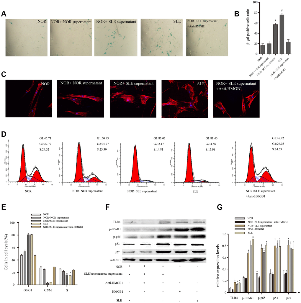 Normal BM-MSCs were treated with bone marrow supernatant from normal persons or SLE patients, or MSCs were cocultured with SLE bone marrow supernatant treated with anti-HMGB1 mAb. Five groups were analyzed. (A, B) BM-MSCs were fixed and stained with SA-β-gal. (C) MSCs were stained by fluorescein isothiocyanate-conjugated phalloidin. The distribution of F-actin was disordered after treatment with bone marrow supernatant from SLE patients by Immunofluorescence. (D, E) Cell viability was assessed by flow cytometry analysis. (F, G) Normal BM-MSCs were treated with SLE bone marrow supernatant or 100 ng/ml HMGB1, or MSCs were cocultured with SLE bone marrow supernatant treated with anti-HMGB1 mAb. Five groups were analyzed. TLR4, p-IRAK1, p-p65, p53 and p27 expressions were analyzed by western blot. GAPDH was used as the internal control. (Bar represents mean ± SD,*P 