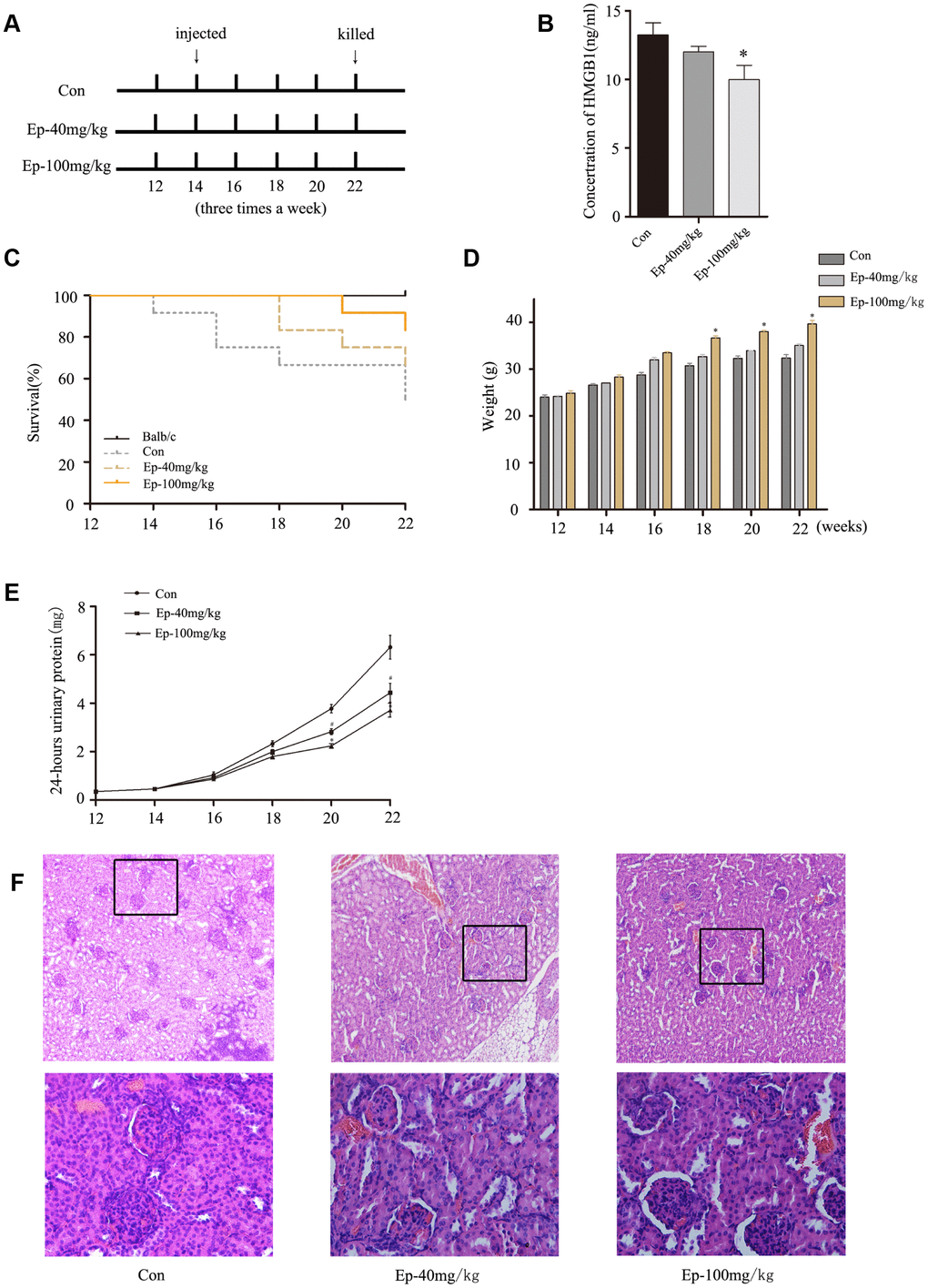 (A) 30 MRL/lpr mice were divided into three groups: MRL/lpr mice treated with normal saline, Ep-40mg/kg-treated MRL/lpr mice and Ep-100mg/kg -treated MRL/lpr mice. Ep was injected intraperitoneally to treat MRL/lpr mice aged 14 weeks for 8 weeks. (B) The expressions of HMGB1 in serum of MRL/lpr mice were examined by Elisa. (C) Survival curves observed that the survival rate of Ep-40mg/kg group and Ep-100mg/kg group was higher than that of control group. (D) Three groups MRL/lpr mice were weighed one time two weeks. (E) 24-hours urinary protein was measured by coomassie brilliant blue method. (F) HE-staining showed that renal pathological changes of MRL/lpr mice were significant, including glomerular sclerosis, mesangial cell proliferation, matrix widened, and lymphocytes infiltrating the interstitium. However, histopathological changes of other groups were alleviated. (Bar represents mean ± SD,*P 