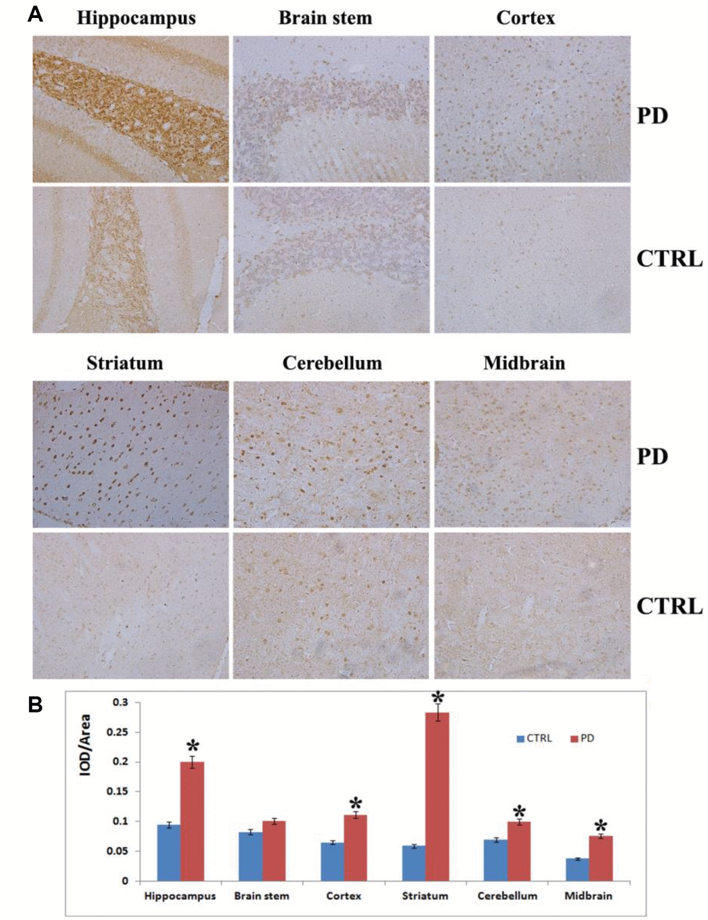 Analysis on α-synuclein expression and aggregation in various brain areas. (A) Representative images showing IHC staining for α-synuclein in the hippocampus, striatum, cortex, midbrain, cerebellum and brain stem (magnification: 100x). (B) Densitometric analysis of α-synuclein levels in the indicated brain areas. Bars depict the mean±SD; *p