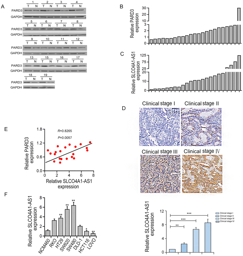 PARD3 protein level parallels to SLCO4A1-AS1 in human CRC tissues. (A, B): Expression of PARD3 protein in CRC tissues (T) (n=23) and the corresponding adjacent control specimens (C) (n=23) by Western blot analysis. (C) PARD3 protein expression was up-regulated in 23 CRC tissues. (D) SLCO4A1-AS1 was elevated gradually with advanced tumor stage (stage I-IV) by in situ hybridization assay; (E) The mRNA expression level of SLCO4A1-AS1 was positively correlated with PARD3 protein in CRC tissues (n=23, R = 0.8265, P = 0.0057); (F) The level of SLCO4A1-AS1 mRNA in CRC cell lines by qRT-PCR. * P 