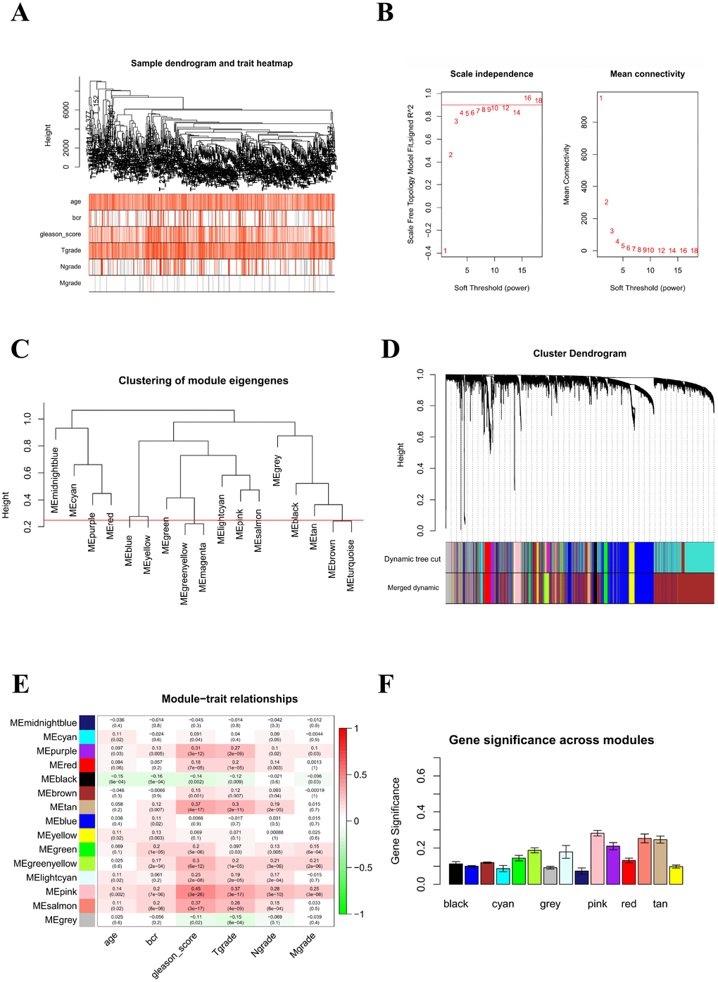 Identification of key modules correlated with clinical traits in the TCGA-PRAD dataset through WGCNA. (A) Clustering dendrograms of genes. The clustering was based on the TCGA-PRAD RNA-seq data of robust DEGs from RRA analysis. Color intensity varies positively with age, Gleason score, and pathological stage. In terms of biochemical recurrence, red means recurrence and white indicates no recurrence. (B) Analysis of the scale-free fit index (left) and the mean connectivity (right) for various soft-thresholding powers. (C) Clustering of module eigengenes. The red line indicates cut height (0.25). (D) Dendrogram of all DEGs clustered based on a dissimilarity measure (1-TOM). (E) Heatmap of the correlation between module eigengenes and clinical traits of PCa. Each cell contains the correlation coefficient and P value. (F) Distribution of average gene significance and errors in the modules associated with Gleason score of PCa.