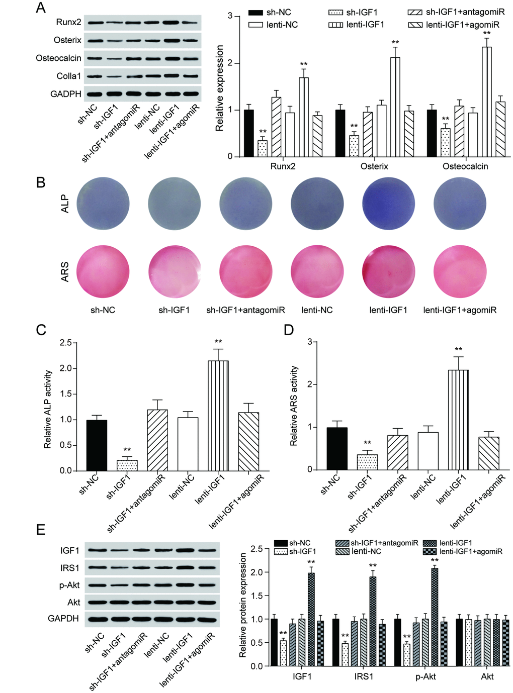 MiR-27a-3p regulated PDLSC osteogenic differentiation through targeting IGF1. (A) Western blot of Runx2, Osterix, Osteocalcin and Colla1 expression in PDLSCs with up-regulation or down-regulation of IGF1. (B–D) ALP and Alizarin Red staining of PDLSCs with different regulation of IGF1. (E) Protein expression of IGF1, IRS1, p-Akt and Akt in PDLSCs with different IGF1 regulation treatment. ** P 