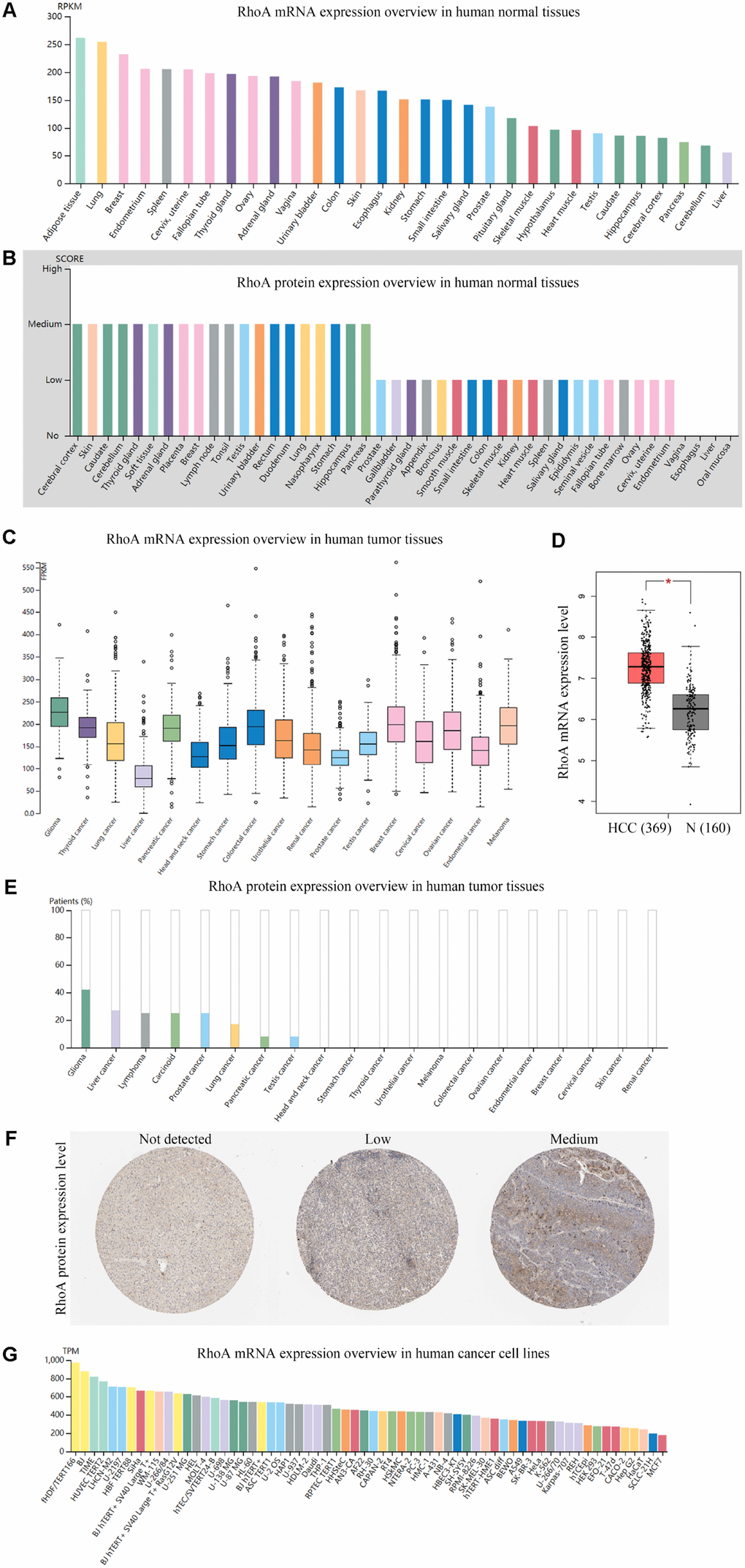 Gene and protein expression profiles of RhoA in tissue samples and cancer cell lines.RhoA mRNA expression (A) data from the GTEx dataset in the Human Protein Atlas) and protein expression (B) data from the Human Protein Atlas) in normal human tissues. RhoA gene expression in common human tumor tissues (C) data from the TCGA dataset in the Human Protein Atlas). Comparison of RhoA mRNA expression between hepatocellular carcinoma tissues and normal liver tissues, including normal TCGA and GTEx data (D) data from GEPIA). RhoA protein expression overview in human tumor tissues (E) data from the TCGA CAB005052 dataset in the Human Protein Atlas) and representative immunohistochemistry (IHC) images (F) pictures from the Human Protein Atlas) with RhoA antibody (1:25, Cat#1600-1, Abcam, Cambridge, UK). RhoA mRNA expression in human cancer cell lines (G, data from RNA cell line category in the Human Protein Atlas).