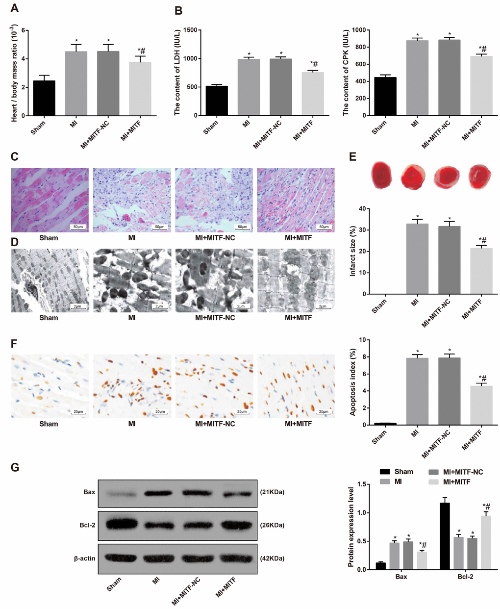 Upregulated MITF expression alleviates pathological damage of cardiac tissues in MI rats. (A) the ratio of heart to body weight, n = 6; (B) serum levels of LDH and CPK examined by the biochemical analyzer, n = 6; (C) HE staining showing pathological changes of cardiac tissues (× 200), n = 3; (D) ultrastructure of cardiomyocytes observed by transmission electron microscope (× 5000), n = 3; (E) TTC staining showing the infarct size of rats, n = 3; (F) TUNEL staining showing the apoptotic index of cardiomyocytes (× 400), n = 3; (G) Western blot assay showing protein levels of apoptosis-related factors Bax and Bcl-2 in cardiac tissues, n = 3; * versus the sham group, P P 