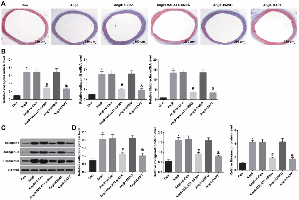 Down-regulated MALAT1 and inhibited Notch-1 alleviate vascular fibrosis. (A) thoracic aorta fibrosis was observed using Masson staining (× 40, scale bar: 250 μm); (B) expression of collagen-I, collagen-III and Fibronectin mRNA in thoracic aorta tissues of rats detected by RT-qPCR; (C) protein bands of collagen-I, collagen-III and Fibronectin in thoracic aorta tissues of rats; (D) expression of collagen-I, collagen-III and Fibronectin in thoracic aorta tissues of rats detected by western blot analysis; * P vs the Con group; # P vs the AngII + si-Con group; & P vs the AngII + DMSO group; n = 10, data were expressed as mean ± standard deviation; one-way ANOVA was used for analyzing data, pairwise comparison was analyzed by Tukey’s post hoc test.