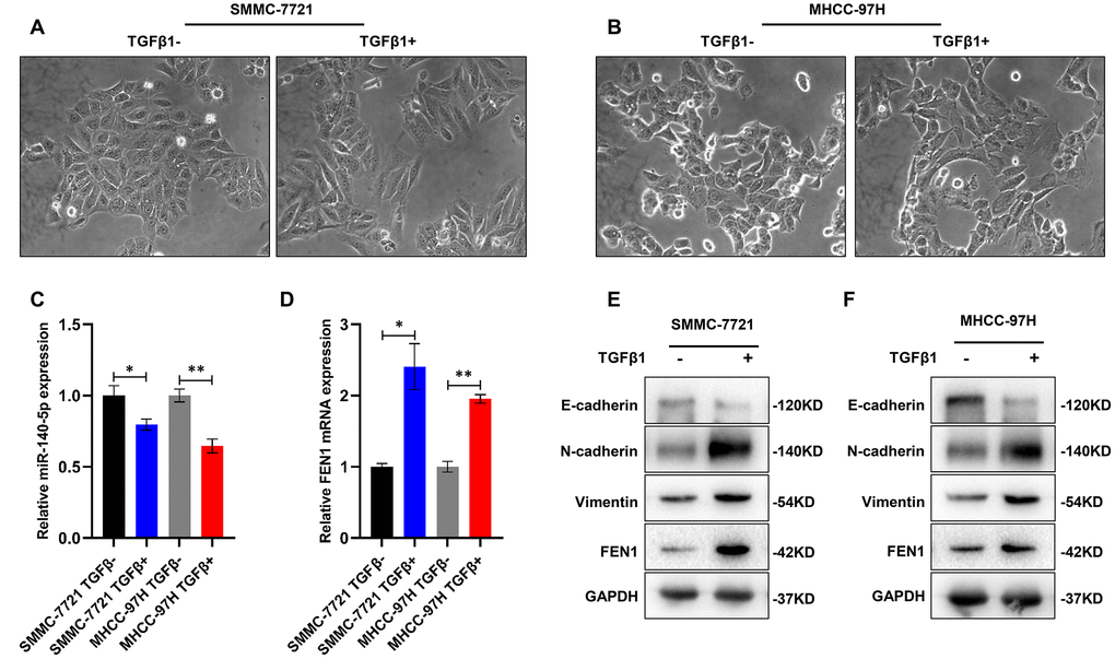 TGF-β1 up-regulates FEN1 and down-regulates miR-140-5p. (A and B) Representative images showing induction of morphological characteristics after 48 h of TGF-β1 (10 ng/mL) treatment. (C and D) RT-qPCR showed that miR-140-5p mRNA was significantly decreased in HCC cells treated with TGF-β1, and FEN1 was up-regulated in TGF-β1-treated HCC cells, *P P E and F) Western blot analysis of EMT markers and FEN1 in TGF-β1-treated HCC cells.