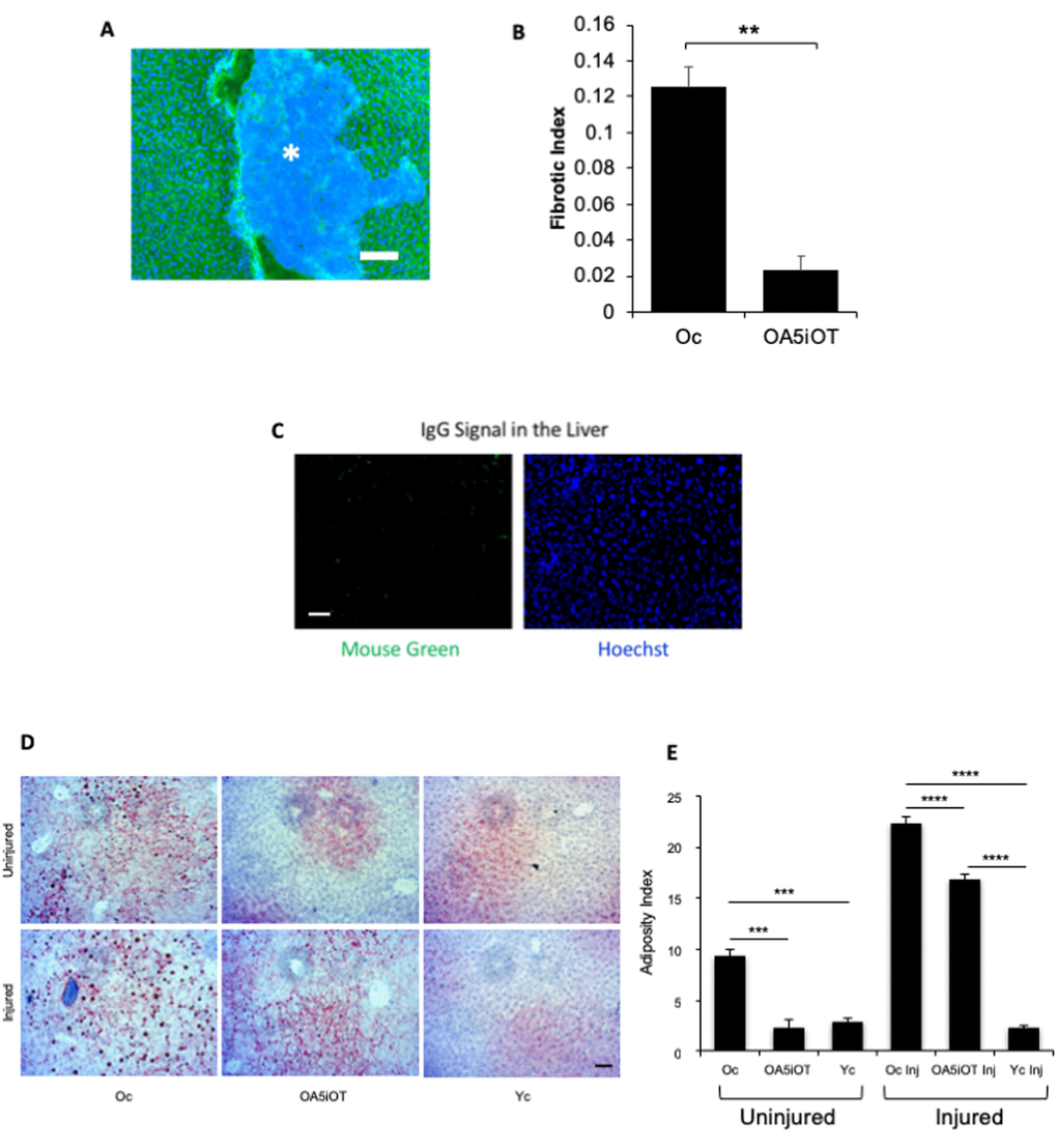 Liver adiposity and fibrosis are reduced in old mice treated with Alk5i+OT. Livers were collected from non-injured mice and at 5 days post cardiotoxin-induced muscle injury, as illustrated in Figure 1C. (A) 10 µm liver sections were immunostained with Albumin+ (green) using Hoechst dye (blue) to label all nuclei, representative image is shown. (B) Albumin-negative fibrotic clusters (commonly found in old, but not young livers) were quantified; the incidence of fibrosis is reduced in the livers of old injured mice that were administered with Alk5i+OT, as compared to HBSS control **p=0.001, N for old control (Oc)=3, N for old+Alk5i+OT (OA5iOT)=3. (C) Isotype-matched IgG signal for albumin immunodetection was minimal. (D) Representative Oil Red O staining of liver sections show an age-specific increase in adiposity and reduction of old liver adiposity by the Alk5i+OT in both injured and uninjured animals. (E) Image J quantification of red pixel density in the Oil Red O assay was performed, as published (Rebo et al, 2016). Alk5i+OT diminished the liver adiposity of the old injured mice. N=6 in each injured cohort, ****p= 0.002 Oc & OA5iOT, N=6 in each uninjured cohort **p