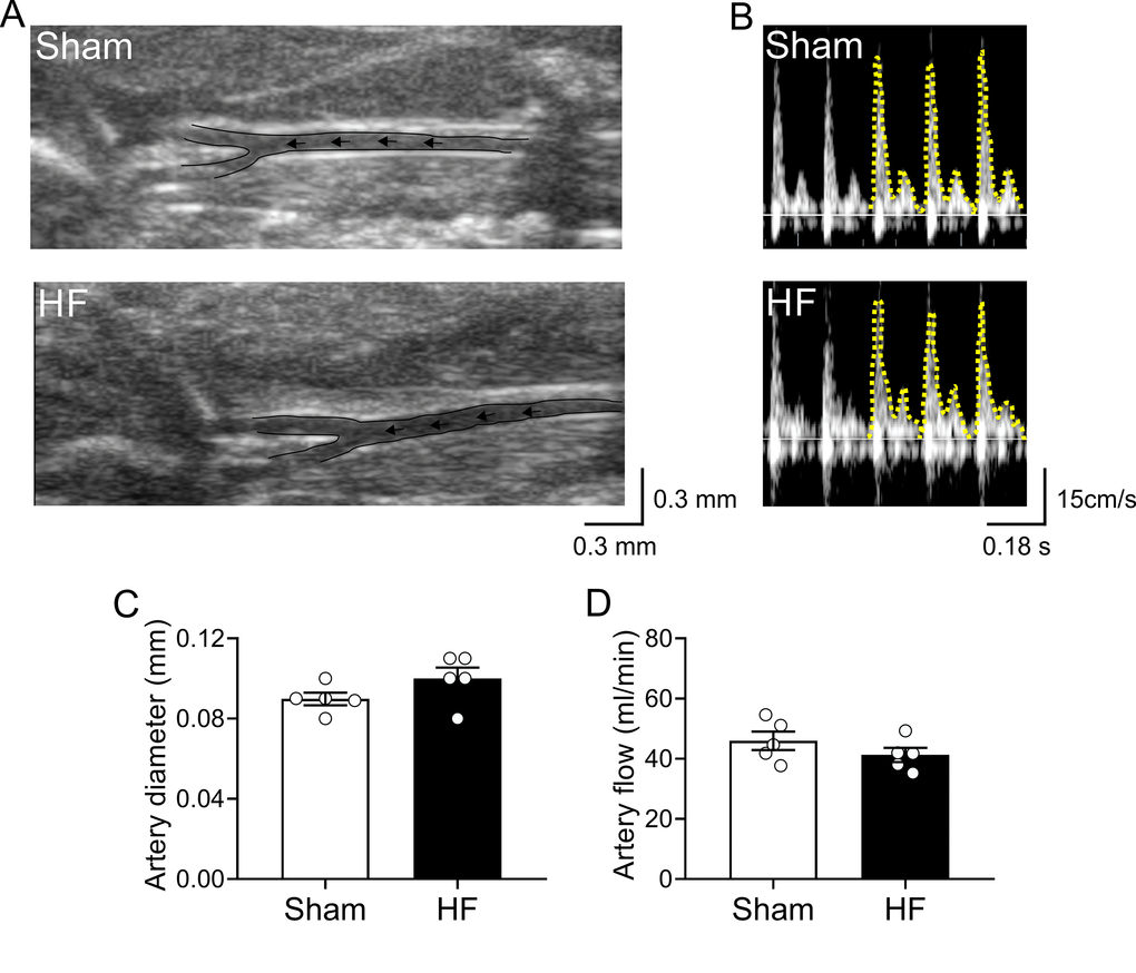 Carotid artery blood flow in high output heart failure. (A) Representative image of ultrasound scanning showing carotid artery in one Sham rat and one HF rat (B) Representative traces of carotid artery blood flow, assessed by Doppler at rest in one Sham rat and one HF rat. (C) Summary data showing carotid artery diameter. (D) Summary data showing carotid artery blood flow. Note that blood flow to the brain region was unaltered between groups. Values are means ± S.E.M. *p 