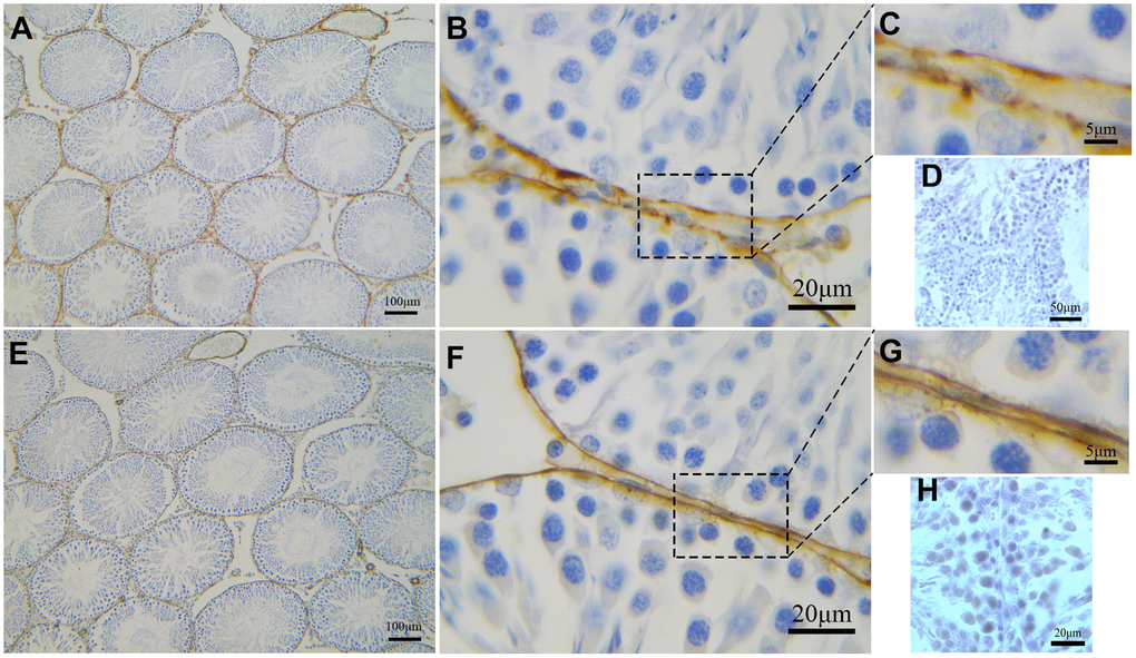 Immunohistochemical analyses of peritubular tissue in the rat testis with anti-αSMA and anti-CD34 antibodies. (A–C) CD34 positive staining (brown) surrounds the seminiferous tubules. Higher magnification (C) shows segmental pattern of CD34 staining. (E–G) αSMA positive staining (brown) also surrounds the seminiferous tubules. Higher magnification (G) shows smooth uniform staining pattern. Higher magnification illustrates the rectangular area. (D, H) shows negative contral group of rat testis. Scale Bar = A, E: 100μm; B, F: 20μm; C, G: 5μm; D: 50μm; H: 20μm.